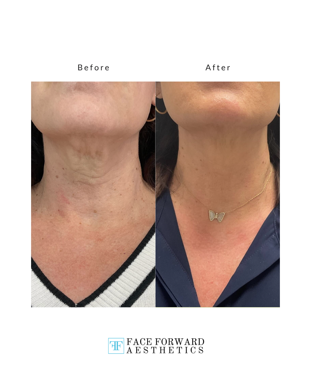 Before + After Template (3)