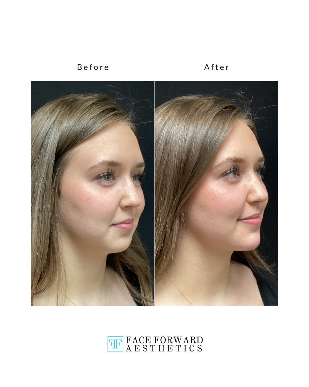 Before + After Template (5)