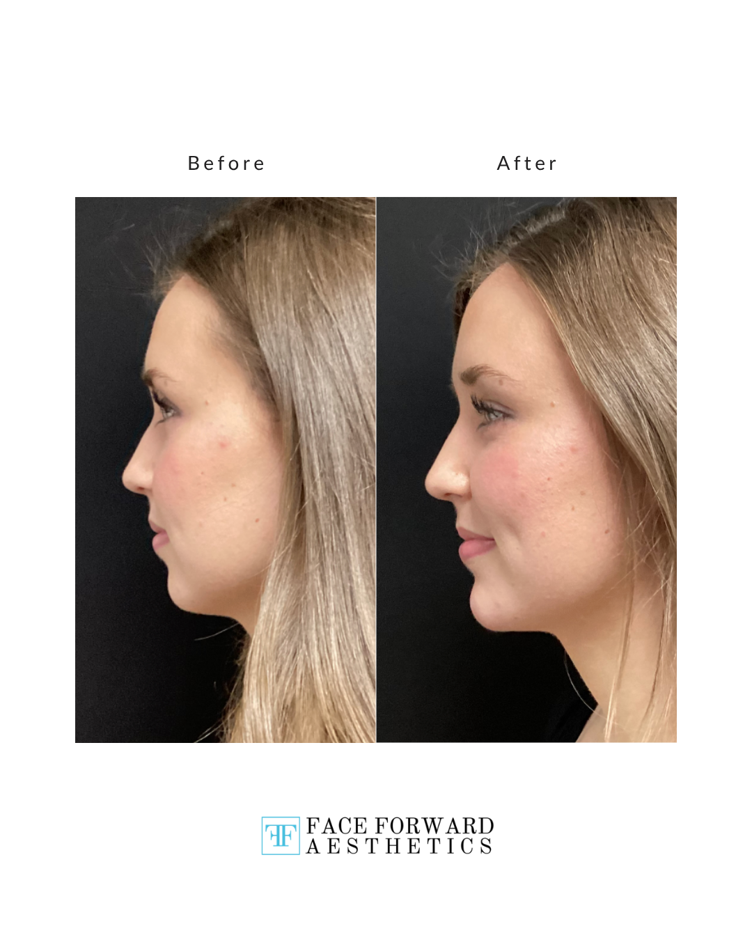 Before + After Template (6)