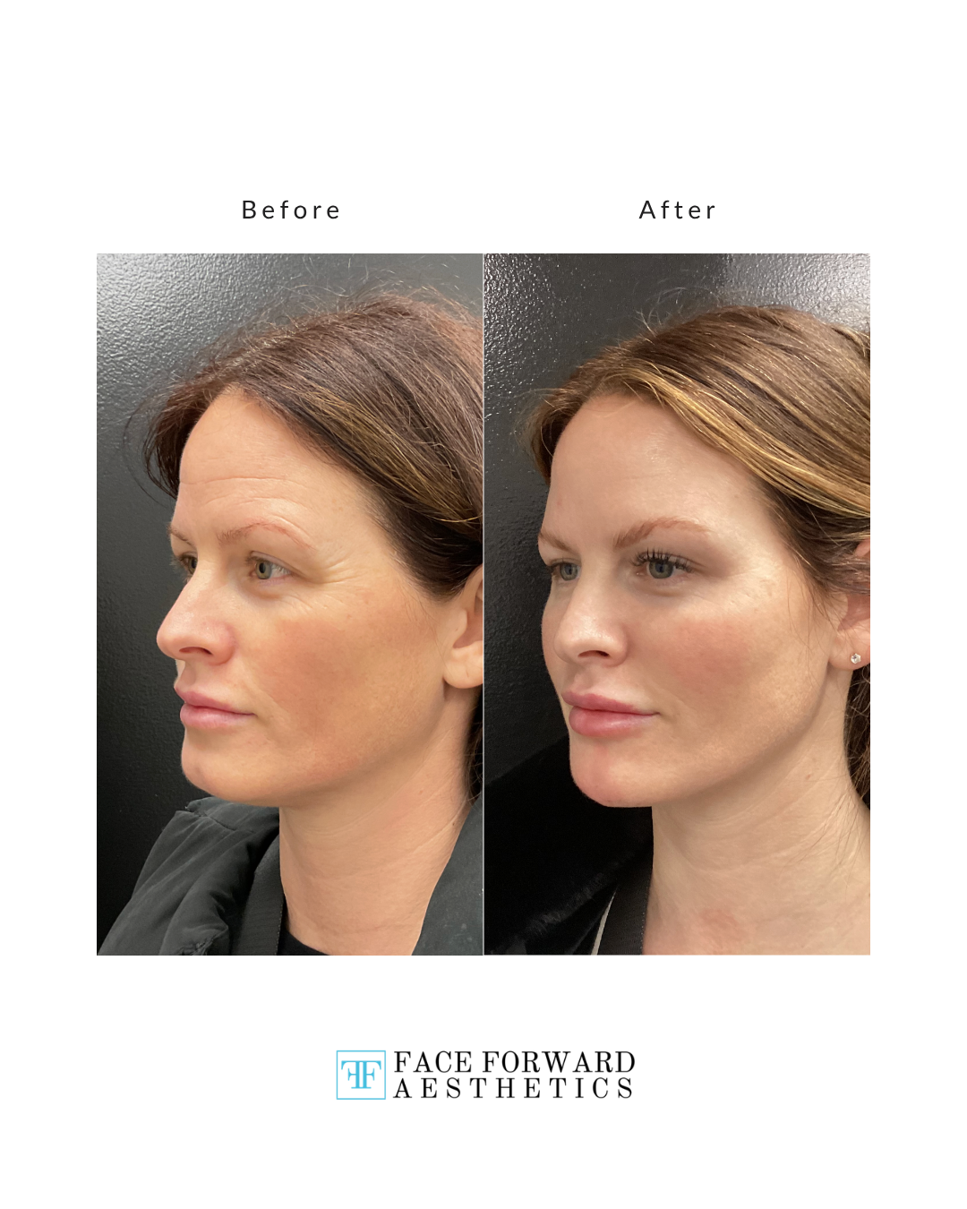 Before + After Template (7)