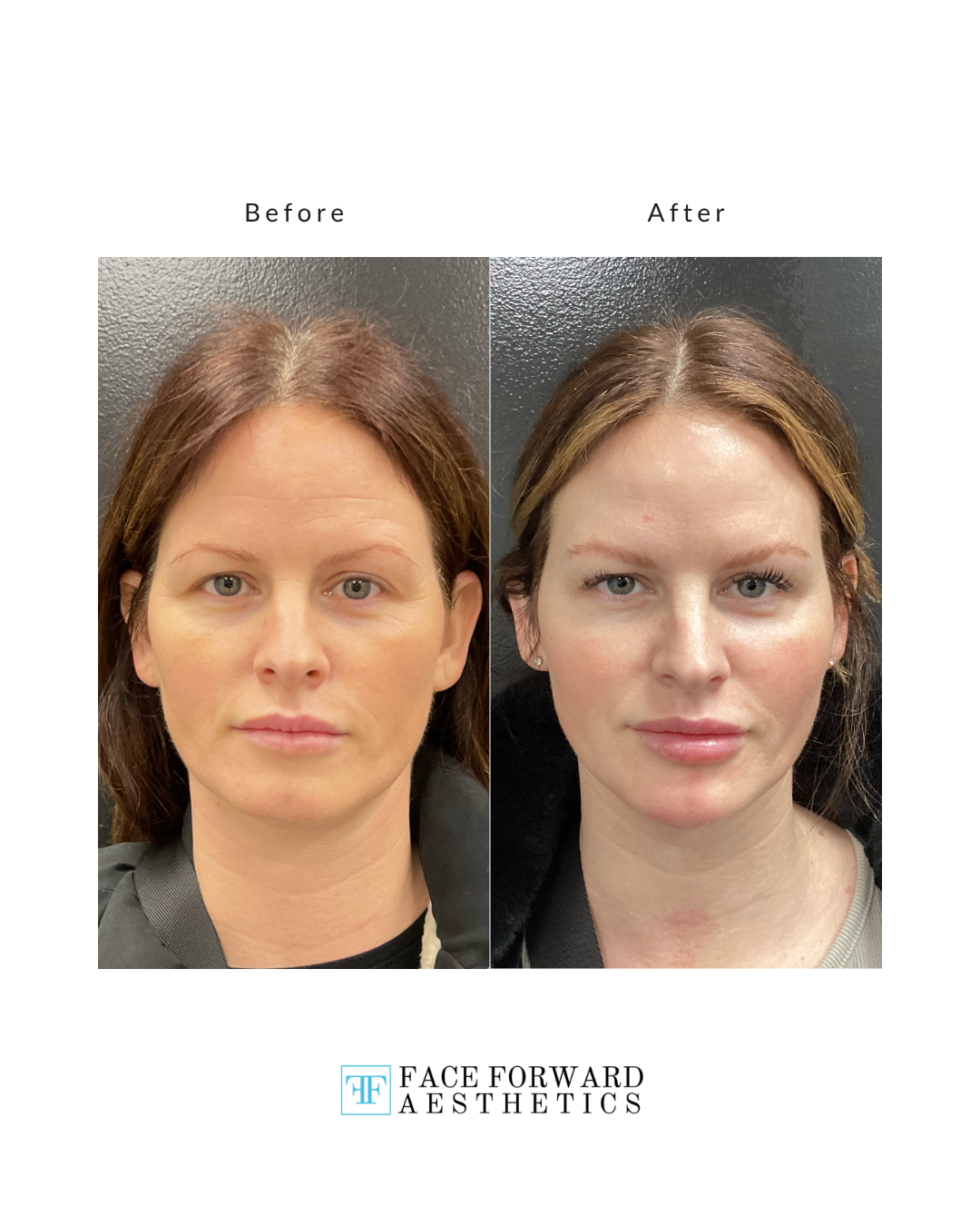 Before + After Template (8)