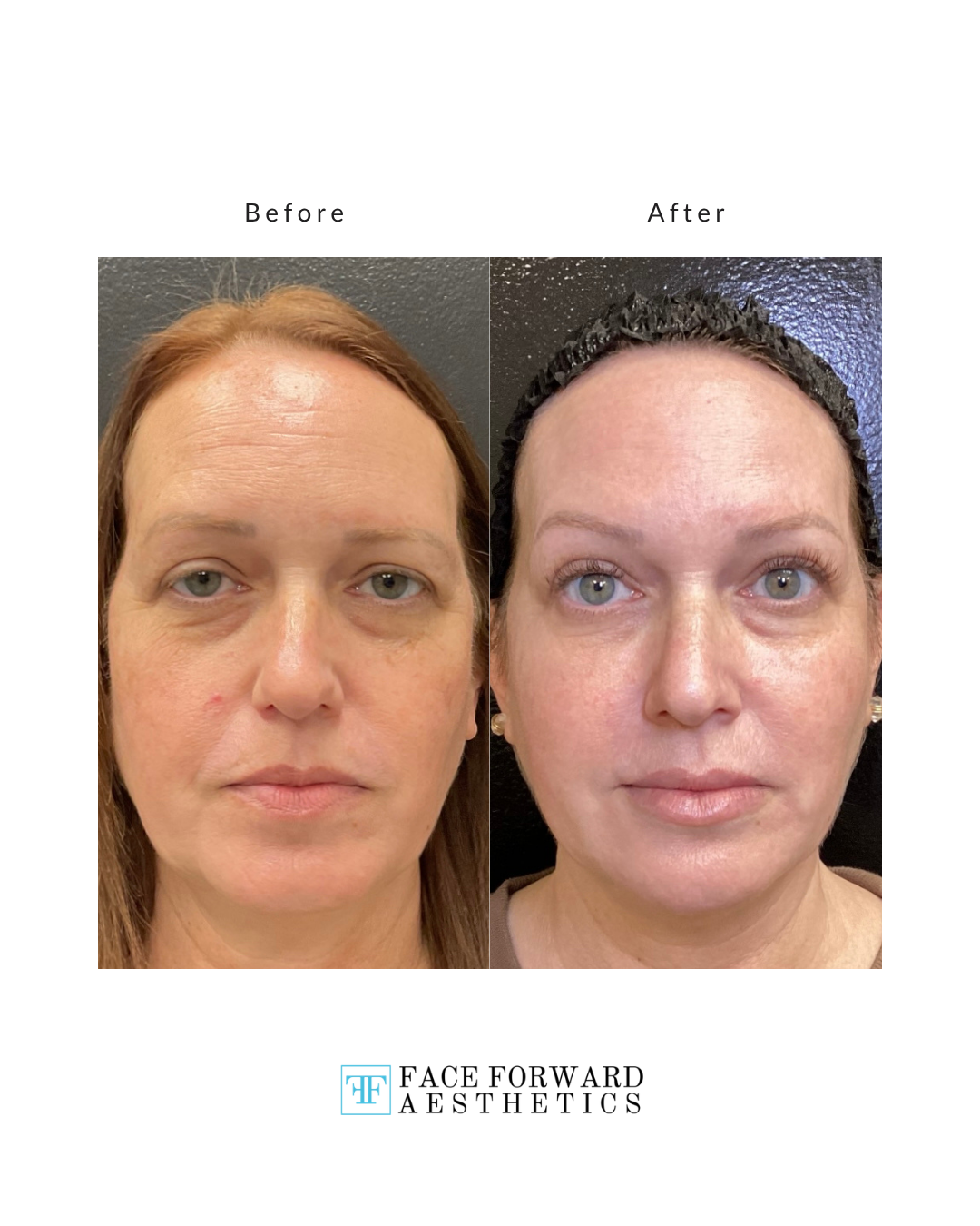 Before + After Template (9)