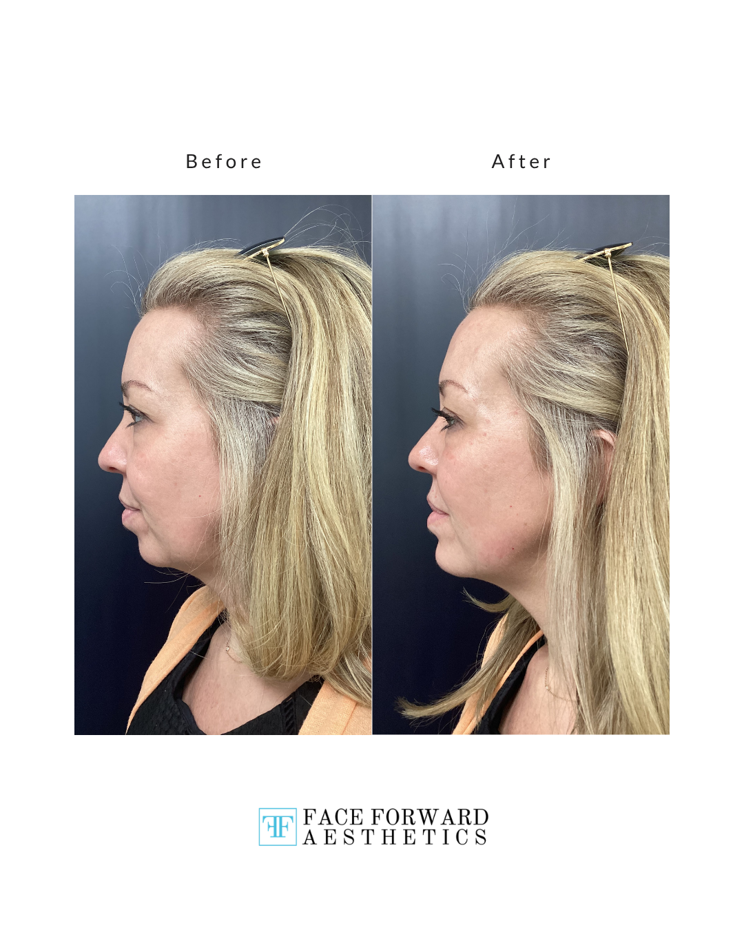 Daniella G 2