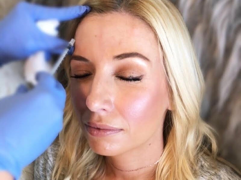 botox for forehead wrinkles