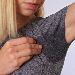 botox injections for sweating