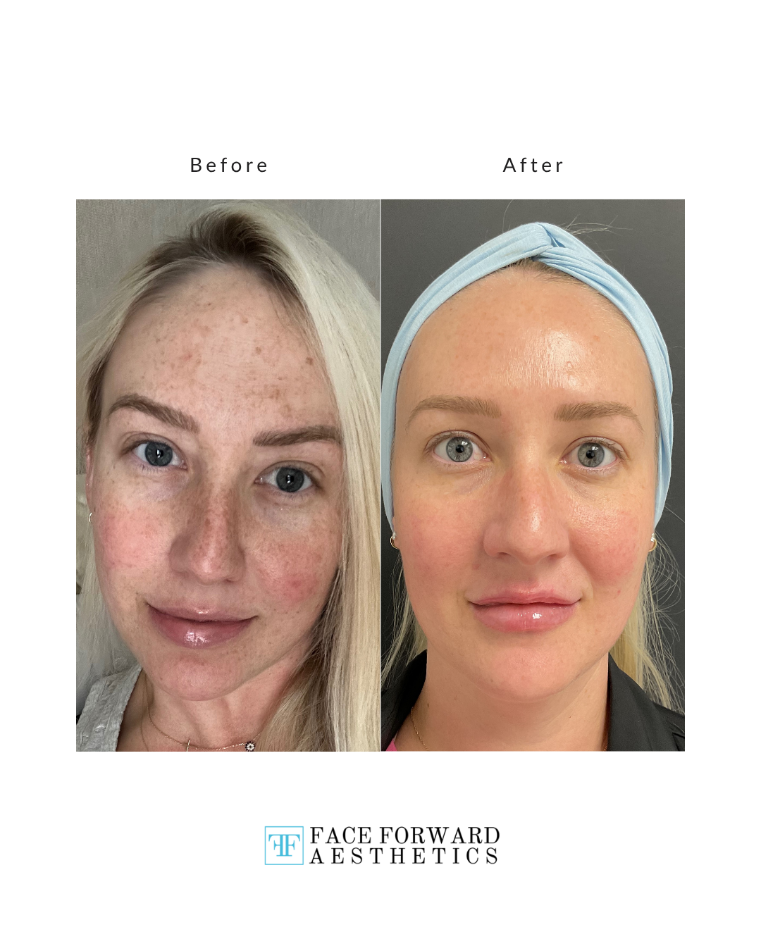 Olivia T. 3 sessions of BBL