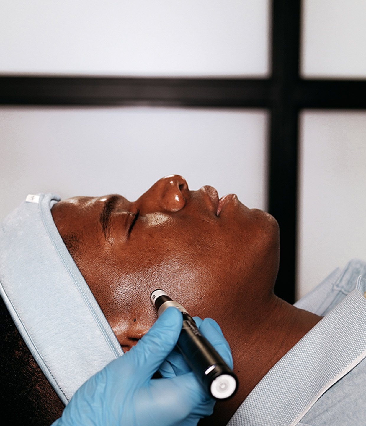 traditional microneedling